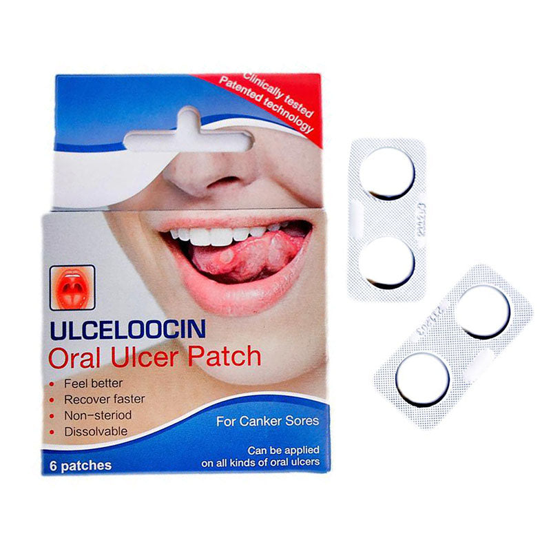 mouth.ulcers wuth glutathione lozenges Mussel-inspired adhesive drug-loaded hydrogels for oral ulcers treatment Mouth Ulcers Treatment Market Size