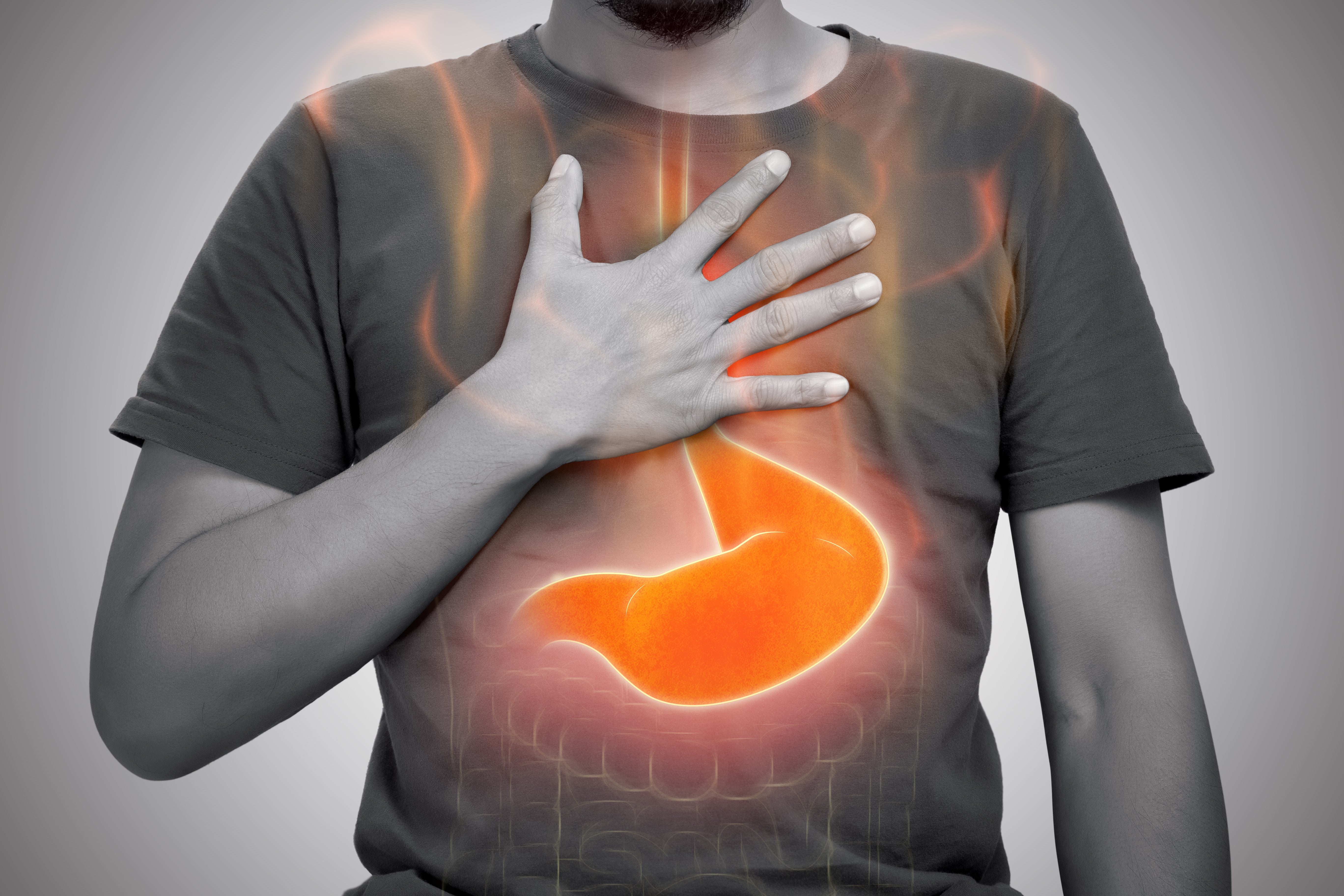 Managing Heartburn During Ramadan: Tips and Solutions | Kulud Pharmacy