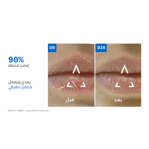 يورياج باريديرم سيكا بلسم شفاه - يصلح ويحمي ويهدئ الشفاه الجافة والمتشققة- 15 مل