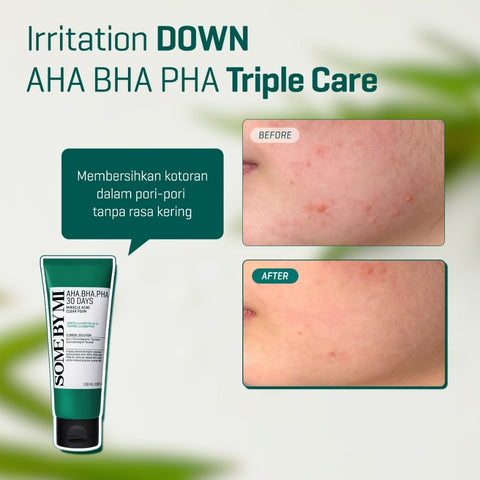 Some By Mi AHA-BHA-PHA 30 Days Miracle Acne Clear Foam 100ml