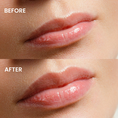 Mia Hype Lip Plumping Lip Gloss 11 Lolita 4.7Ml